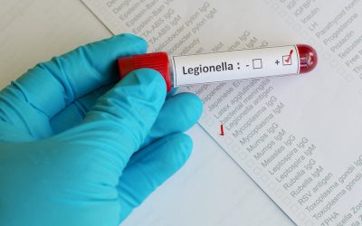 What is Legionella Testing?